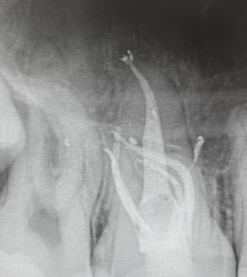 Comprehensive Advanced Endodontics